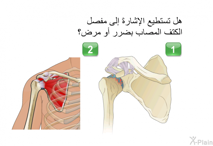 هل تستطيع الإشارةَ إلى مفصل الكتف المصاب بضرر أو مرض؟