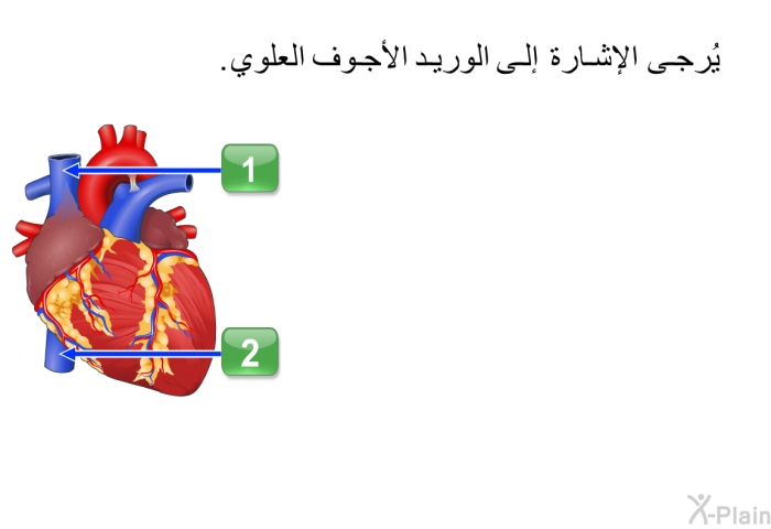 يُرجى الإشارة إلى الوريد الأجوف العلوي.