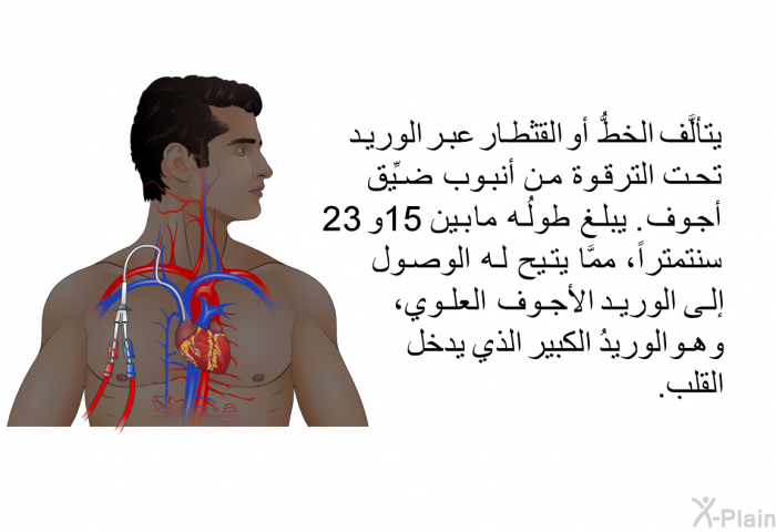 يتألَّف الخطُّ أو القثطار عبر الوريد تحت الترقوة من أنبوب ضيِّق أجوف. يبلغ طولُه بين 15 و 23 سنتمتراً، ممَّا يتيح له الوصول إلى الوريد الأجوف العلوي، وهو الوريدُ الكبير الذي يدخل القلب.