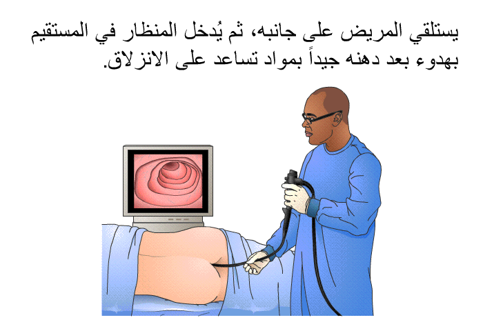 يستلقي المريض على جانبه، ثم يُدخل المنظار في المستقيم بهدوء بعد دهنه جيداً بمواد تساعد على الانزلاق.