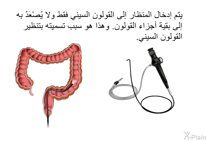 يتم إدخال المنظار إلى القولون السيني فقط ولا يُصْعَدُ به إلى بقية أجزاء القولون. وهذا هو سبب تسميته بتنظير القولون السيني.