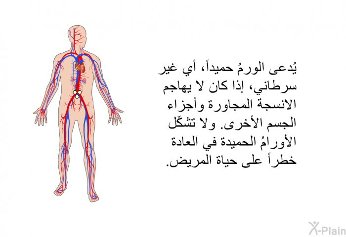 يُدعى الورمُ حميداً، أي غير سرطانيٍّ، إذا كان لا يهاجم الانسجة المجاورة وأجزاء الجسم الأخرى. ولا تشكِّل الأورامُ الحميدة في العادة خطراً على حياة المريض.