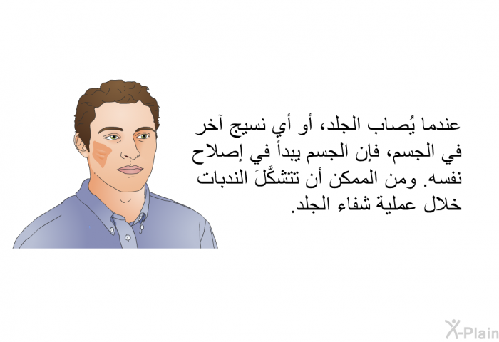 عندما يُصاب الجلد، أو أي نسيج آخر في الجسم، فإن الجسم يبدأ في إصلاح نفسه. ومن الممكن أن تتشكَّلَ الندبات خلال عملية شفاء الجلد.