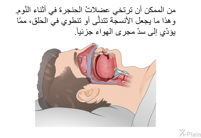 من الممكن أن ترتخي عضلاتُ الحنجرة في أثناء النَّوم. وهذا ما يجعل الأنسجة تتدلَّى أو تنطوي في الحَلق، ممَّا يؤدِّي إلى سدِّ مجرى الهواء جزئياً.