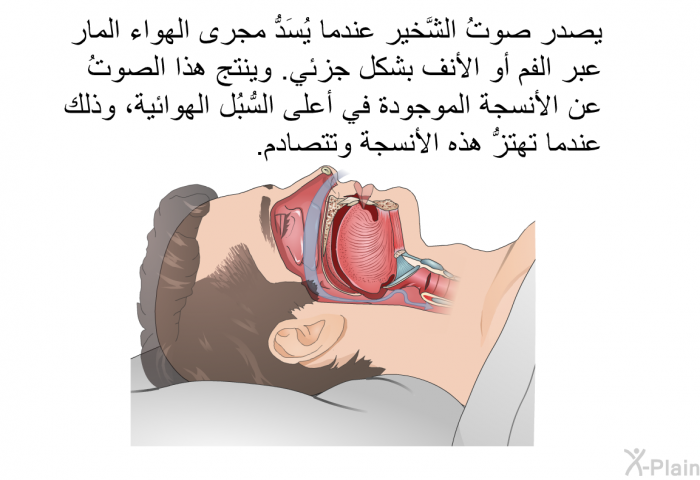 يصدر صوتُ الشَّخير عندما يُسَدُّ مجرى الهواء المار عبر الفم أو الأنف بشكل جزئي. وينتج هذا الصوتُ عن الأنسجة الموجودة في أعلى السُّبُل الهوائية، وذلك عندما تهتزُّ هذه الأنسجة وتتصادم.