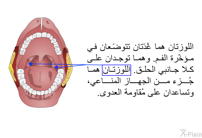 اللوزتان هما غُدّتان تتوضّعان في مؤخِّرة الفم. وهما توجدان على كلا جانبي الحلق. اللوزتان هما جُزءٌ من الجهاز المناعي، وتساعدان على مُقاومة العدوى.