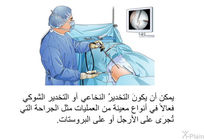 يمكن أن يكونَ التخديرُ النخاعي أو التخدير الشوكي فعالاً في أنواع معينة من العمليات مثل الجراحة التي تُجرَى على الأرجل أو على البروستات.