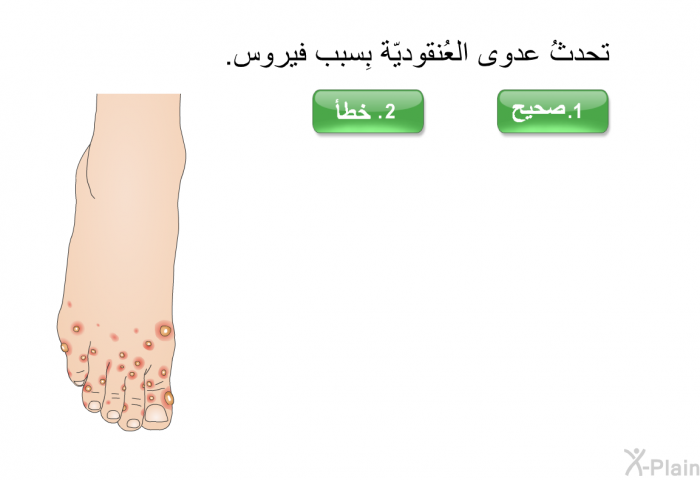 تحدثُ عدوى العُنقوديّة بِسبب فيروس.