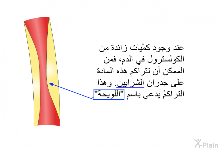 عند وجود كمِّيات زائدة من الكولسترول في الدم، فمن الممكن أن تتراكم هذه المادة على جدران الشرايين. وهذا التراكمُ يدعى باسم "اللويحة".