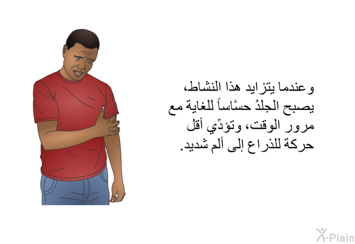 وعندما يتزايد هذا النشاط، يصبح الجلدُ حسَّاساً للغاية مع مرور الوقت، وتؤدِّي أقل حركة للذراع إلى ألم شديد.