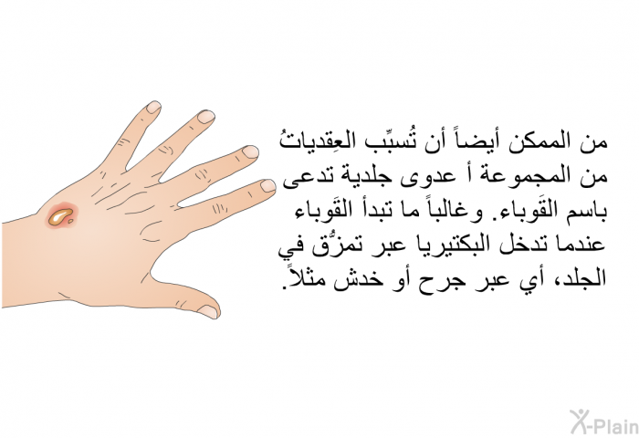 من الممكن أيضاً أن تُسبِّب العِقدياتُ من المجموعة أ عدوى جلدية تدعى باسم القَوباء. وغالباً ما تبدأ القَوباء عندما تدخل البكتيريا عبر تمزُّق في الجلد، أي عبر جرح أو خدش مثلاً.