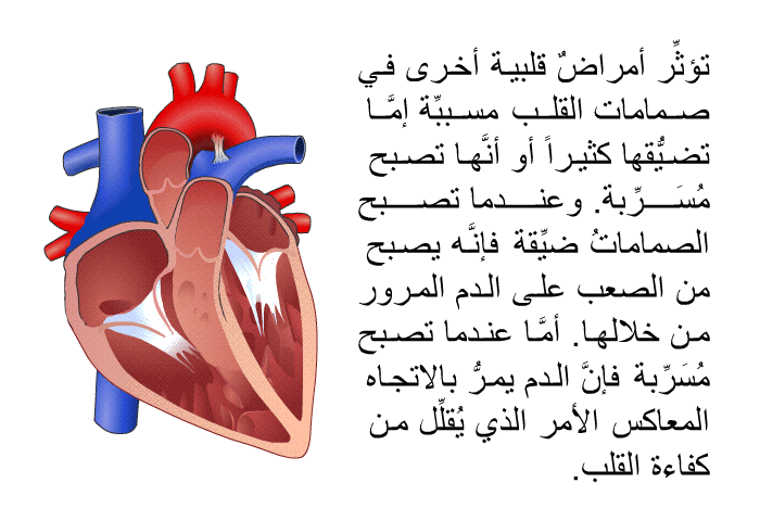 تؤثِّر أمراضٌ قلبية أخرى في صمامات القلب، مسببِّة إمَّا تضيُّقها كثيراً، أو أنَّها تصبح مُسَرِّبة. وعندما تصبح الصماماتُ ضيِّقة، فإنَّه يصبح من الصعب على الدم المرور من خلالها. أمَّا عندما تصبح مُسَرِّبة، فإنَّ الدم يمرُّ بالاتجاه المعاكس، الأمر الذي يُقلِّل من كفاءة القلب.