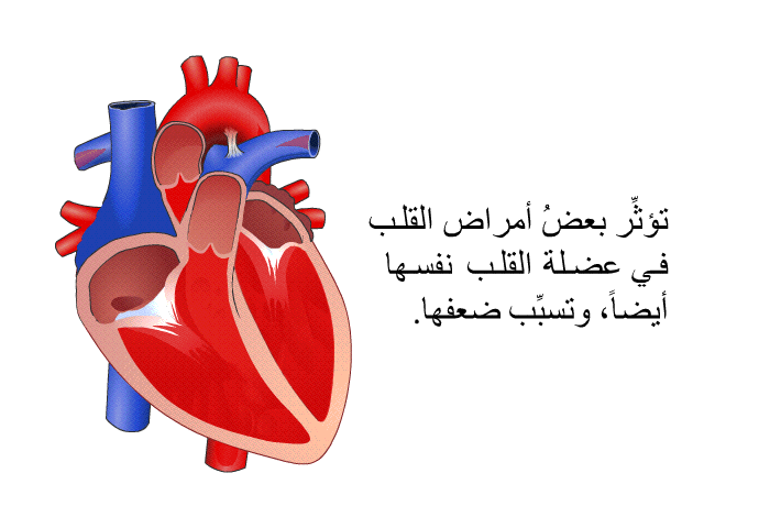 تؤثِّر بعضُ أمراض القلب في عضلة القلب نفسها أيضاً، وتسبِّب ضعفها.