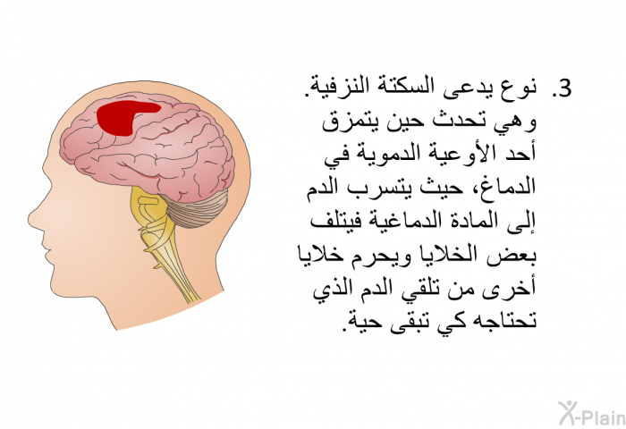 نوع يدعى السكتة النزفية. وهي تحدث حين يتمزق أحد الأوعية الدموية في الدماغ، حيث يتسرب الدم إلى المادة الدماغية فيتلف بعض الخلايا ويحرم خلايا أخرى من تلقي الدم الذي تحتاجه كي تبقى حية.