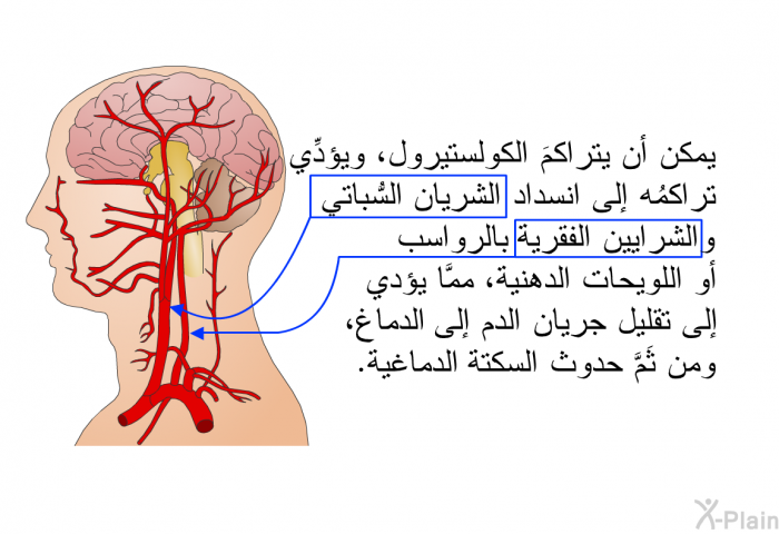 يمكن أن يتراكمَ الكولستيرول، ويؤدِّي تراكمُه إلى انسداد الشريان السُّباتي والشرايين الفقرية بالرواسب أو اللويحات الدهنية، ممَّا يؤدي إلى تقليل جريان الدم إلى الدماغ، ومن ثَمَّ حدوث السكتة الدماغية<I>.</I>