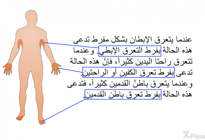 عندما يتعرق الإبطان بشكل مفرط تدعى هذه الحالة بفرط التعرق الإبطي. وعندما تتَعَرُّق راحتا اليدين كثيراً، فإنَّ هذه الحالة تدعى بفَرط تَعَرُّق الكفين أو الرَّاحتين. وعندما يتعَرَّق باطنُ القدمين كثيراً، فتدعى هذه الحالة بفَرط تَعَرُّق باطن القدمين.