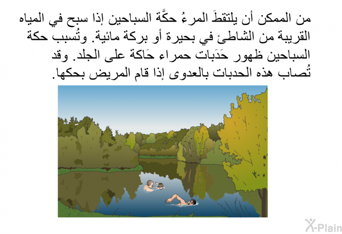 من الممكن أن يلتقطَ المرءُ حكَّة السباحين إذا سبح في المياه القريبة من الشاطئ في بحيرة أو بركة مائية. وتُسبب حكة السباحين ظهور حَدَبات حمراء حَاكة على الجلد. وقد تُصاب هذه الحدبات بالعدوى إذا قام المريض بحكها.