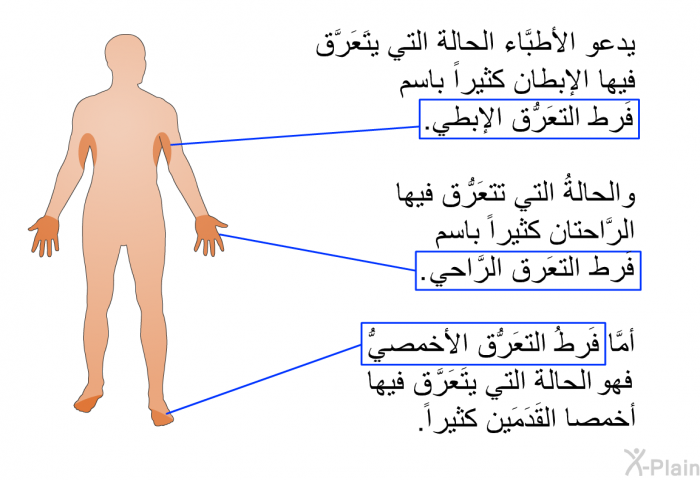 يدعو الأطِبَّاء الحالة التي يتَعَرَّق فيها الإبطان كثيراً باسم فَرط التعَرُّق الإبطي. والحالةُ التي تتعَرُّق فيها الرَّاحتان كثيراً باسم فَرط التعَرُّق الرَّاحي. أمَّا فَرطُ التعَرُّق الأخمصيُّ فهو الحالة التي يتَعَرَّق فيها أخمصا القَدَمَين كثيراً.