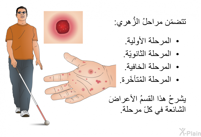 تتضمّن مراحلُ الزُّهري:   المرحلة الأولية.  المرحلة الثانويّة.  المرحلة الخافية.  المرحلة المُتأخّرة.  
 يشرحُ هذا القسمُ الأعراضَ الشائعة في كلّ مرحلة.