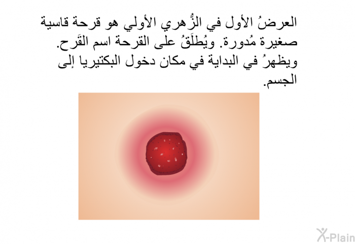 العرضُ الأول في الزُّهري الأولي هو قرحة قاسية صغيرة مُدورة. ويُطلَقُ على القرحة اسم القَرح. ويظهرُ في البداية في مكان دخول البكتيريا إلى الجسم.