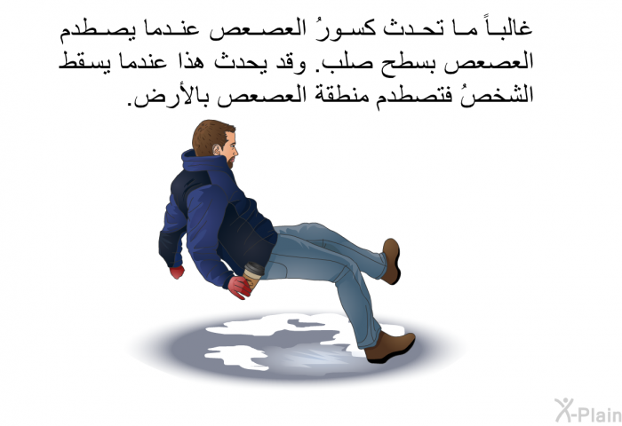 غالباً ما تحدث كسورُ العصعص عندما يصطدم العصعص بسطح صلب. وقد يحدث هذا عندما يسقط الشخصُ فتصطدم منطقة العصعص بالأرض.