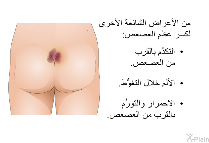 من الأعراض الشائعة الأخرى لكسر عظم العصعص:  التكدُّم بالقرب من العصعص. الألم خلال التغوُّط. الاحمرار والتورُّم بالقرب من العصعص.