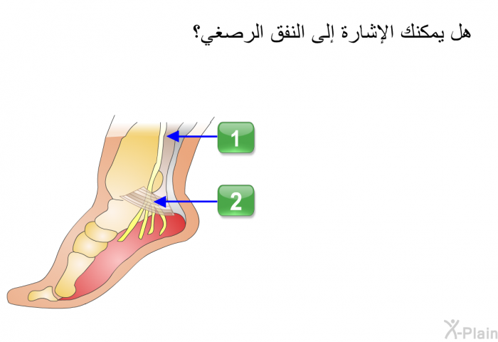 هل يمكنك الإشارة إلى النفق الرصغي؟.