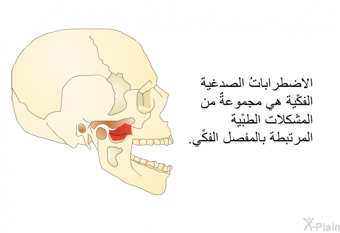 الاضطراباتُ الصدغية الفكِّية هي مجموعةٌ من المشكلات الطبِّية المرتبطة بالمفصل الفكِّي.