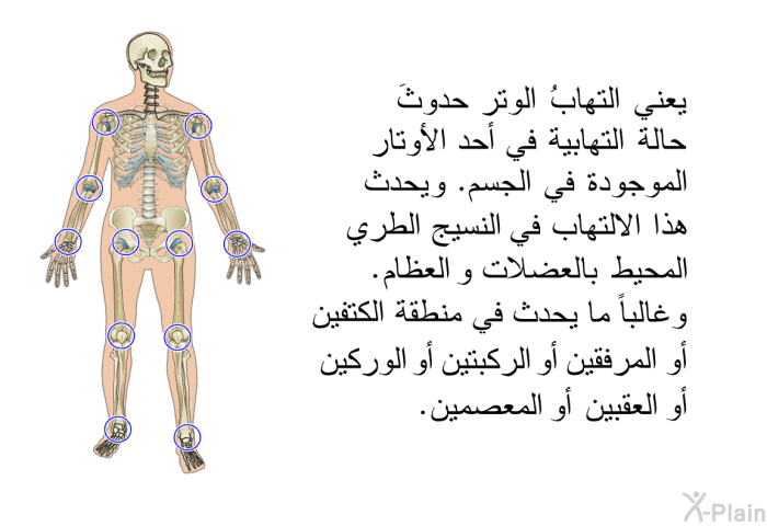 يعني التهابُ الوتر حدوثَ حالة التهابية في أحد الأوتار الموجودة في الجسم. ويحدث هذا الالتهاب في النسيج الطري المحيط بالعضلات والعظام. وغالباً ما يحدث في منطقة الكتفين أو المرفقين أو الركبتين أو الوركين أو العقبين أو المعصمين.