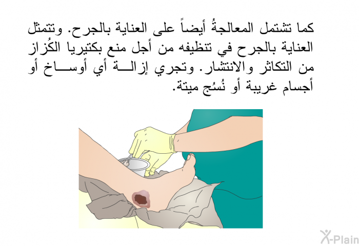 كما تشتمل المعالجةُ أيضاً على العناية بالجرح. وتتمثل العناية بالجرح في تنظيفه من أجل منع بكتيريا الكُزاز من التكاثر والانتشار. وتجري إزالة أي أوساخ أو أجسام غريبة أو نُسُج ميتة.