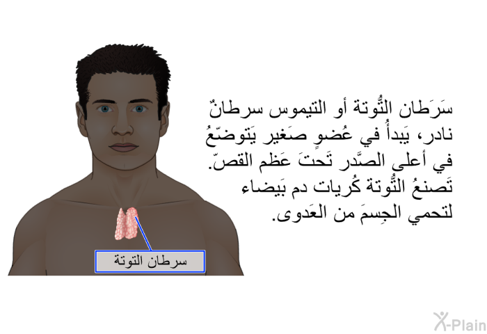 سَرَطان التُّوتة أو التيموس سرطانٌ نادر، يَبدأُ في عُضوٍ صَغير يَتوضّعُ في أعلى الصَّدر تَحتَ عَظم القصّ. تَصنعُ التُّوتة كُريات دم بَيضاء لتحمي الجِسمَ من العَدوى.