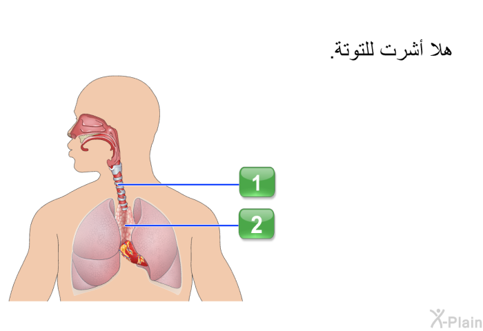 هلا أشرت للتوتة.