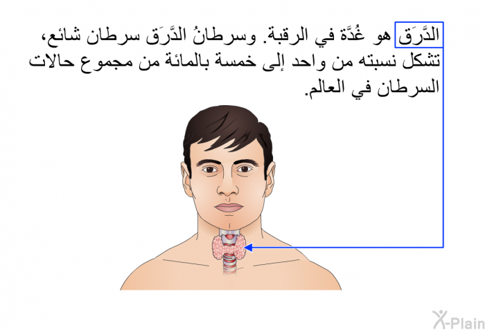 الدَّرَق هو غُدَّة في الرقبة. وسرطانُ الدَّرَق سرطان شائع، تشكِّل نسبته من واحد إلى خمسة بالمائة من مجموع حالات السرطان في العالم.