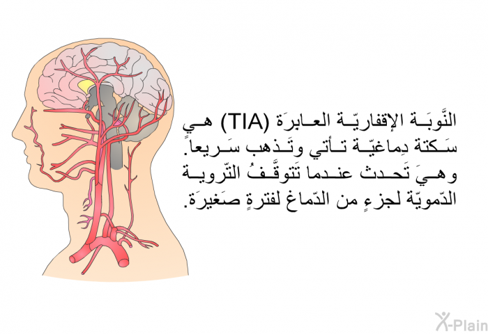 النَّوبَة الإقفاريّة العابِرَة (TIA) هي سَكتة دِماغيّة تأتي وتَذهب سَريعاً. وهيَ تَحدث عندما تَتوقَّفُ التّروية الدّمويّة لجزءٍ من الدّماغ لفترةٍ صَغيرَة.
