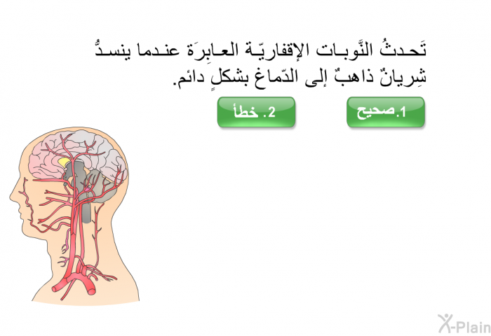 تَحدثُ النَّوبات الإقفاريّة العابِرَة عندما ينسدُّ شِريانٌ ذاهبٌ إلى الدّماغ بشكلٍ دائم.