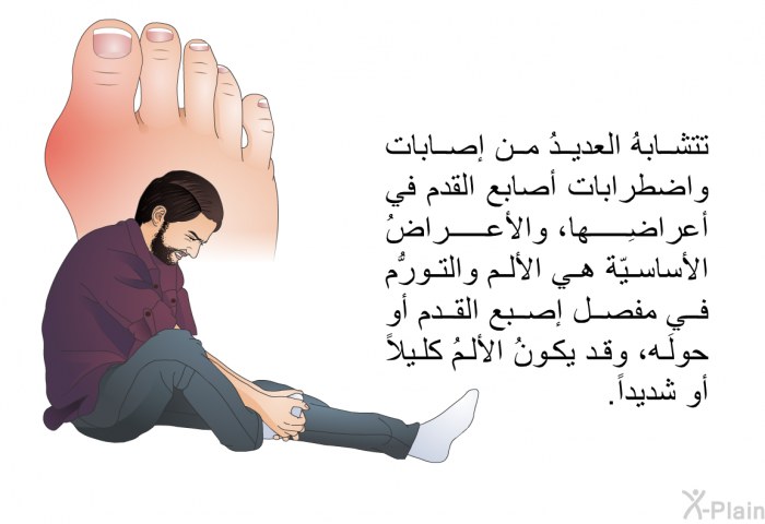 تتشابهُ العديدُ من إصابات واضطرابات أصابع القدم في أعراضِها، والأعراضُ الأساسيّة هي الألم والتورُّم في مفصل إصبع القدم أو حولَه، وقد يكونُ الألمُ كليلاً أو شديداً.