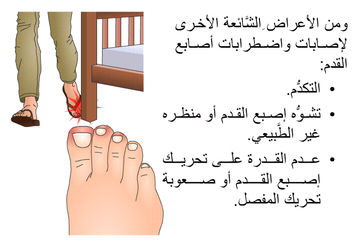 ومن الأعراضِ الشَّائعة الأخرى لإصابات واضطرابات أصابع القدم:  التكدُّم. تشوُّه إصبع القدم أو منظره غير الطَّبيعي. عدم القدرة على تحريك إصبع القدم أو صعوبة تحريك المفصل.