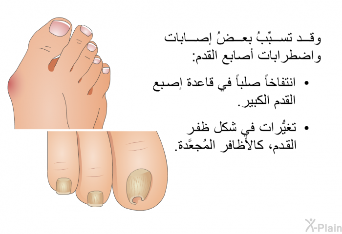 وقد تسبِّبُ بعضُ إصابات واضطرابات أصابع القدم:  انتفاخاً صلباً في قاعدة إصبع القدم الكبير. تغيُّرات في شكل ظفر القدم، كالأظافر المُجعَّدة.
