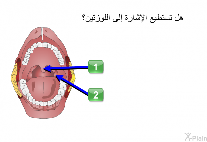 هل تستطيع الإشارة إلى اللوزتين؟