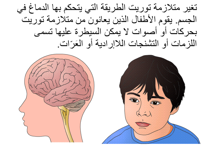 تغير متلازمة توريت الطريقة التي يتحكم بها الدماغ في الجسم. يقوم الأطفال الذين يعانون من متلازمة توريت بحركات أو أصوات لا يمكن السيطرة عليها تسمى اللزمات أو التشنجات اللاإرادية أو العَرّات.