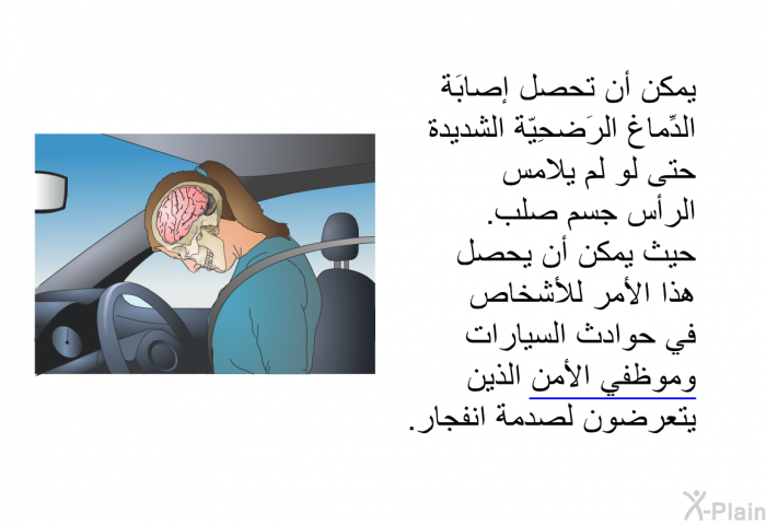 يمكن أن تحصل إصابَة الدِّماغ الرَضحِيّة الشَدِيدَة حتى لو لم يلامس الرأس جِسمٌ صَلب. حيث يمكن أن يحصل هذا الأمر للأشخاص في حَوادث السيارات ومَوظفي الأمن الذين يتعرضون لصَدمَة انفجار.
