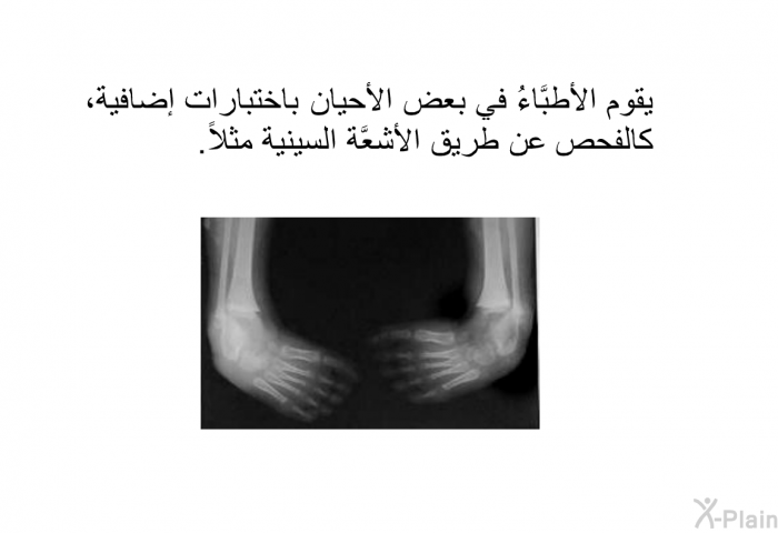 يقوم الأطبَّاءُ في بعض الأحيان باختبارات إضافية، كالفحص عن طريق الأشعَّة السينية مثلاً.