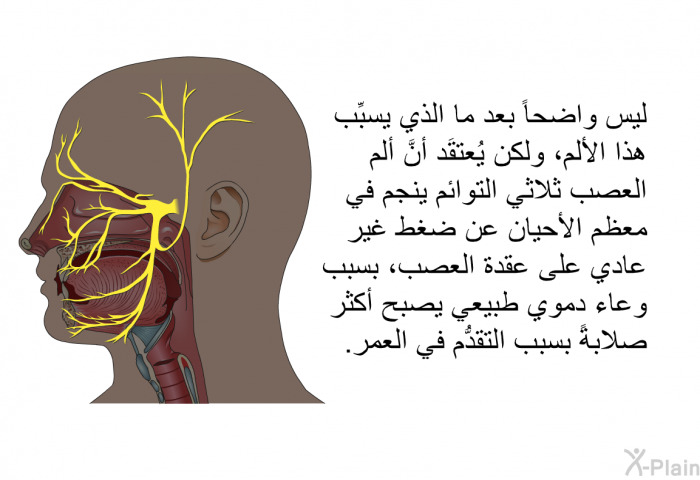 ليس واضحاً بعد ما الذي يسبِّب هذا الألم، ولكن يُعتقَد أنَّ ألم العصب ثلاثي التوائم ينجم في معظم الأحيان عن ضغط غير عادي على عقدة العصب، بسبب وعاء دموي طبيعي يصبح أكثر صلابةً بسبب التقدُّم في العمر.