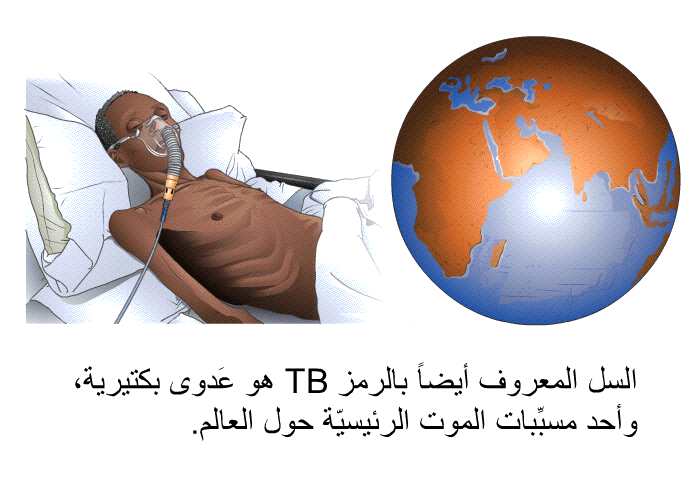 السل المعروف أيضاً بالرّمز TB هو عَدوى بكتيرية، وأحد مسبِّبات الموت الرئيسيّة حول العالم.