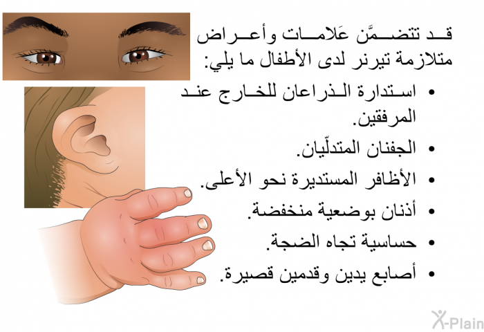 قد تتضمَّن عَلامات وأعراض متلازمة تيرنر لدى الأطفال ما يلي:  استدارة الذراعان للخارج عند المرفقين. الجفنان المتدلّيان. الأظافر المستديرة نحو الأعلى. أذنان بوضعية منخفضة. حساسية تجاه الضجة. أصابع يدين وقدمين قصيرة.