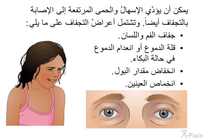 يمكن أن يؤدِّي الإسهالُ والحمى المرتفعة إلى الإصابة بالتجفاف أيضاً. وتشتمل أعراضُ التجفاف على ما يلي:  جفاف الفم واللسان. قلة الدموع أو انعدام الدموع في حالة البكاء. انخفاض مقدار البول. انخِماص العينين.