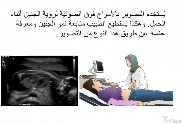 يُستخدم التصوير بالأمواج فوق الصوتيّة لرؤية الجنين أثناء الحمل. وهكذا يستطيع الطبيب متابعة نمو الجنين ومعرفة جنسه عن طريق هذا النوع من التصوير.