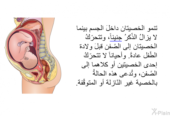 تنمو الخصيتان داخلَ الجسم بينما لا يزالُ الذّكرُ جنيناً، وتتحرّكُ الخصيتان إلى الصَّفن قبلَ ولادة الطّفل عادةً. وأحياناً لا تتحرّكُ إحدى الخصيتين أو كلاهما إلى الصَّفن، وتُدعى هذه الحالةُ بالخصية غير النّازلة أو المتوقِّفة.