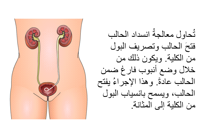 تُحاول معالجةُ انسداد الحالب فتحَ الحالب وتصريف البول من الكلية. ويكون ذلك من خلال وضع أنبوب فارغ ضمن الحالب عادةً. وهذا الإجراءُ يفتح الحالب، ويسمح بانسياب البول من الكلية إلى المثانة.