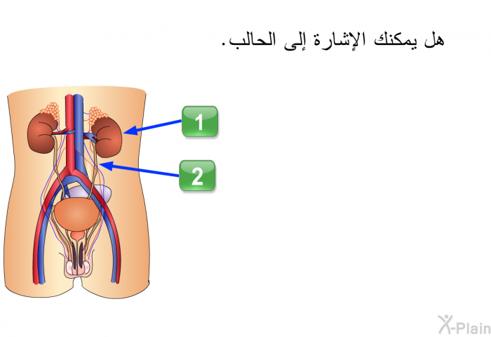 هل يمكنك الإشارة إلى الحالب.